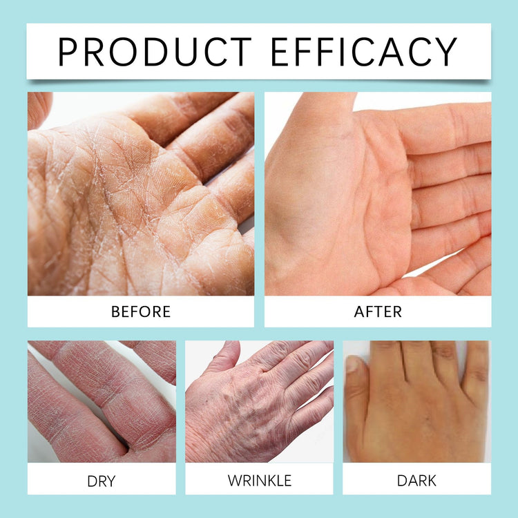Before and after comparison of skin conditions on hands with text &