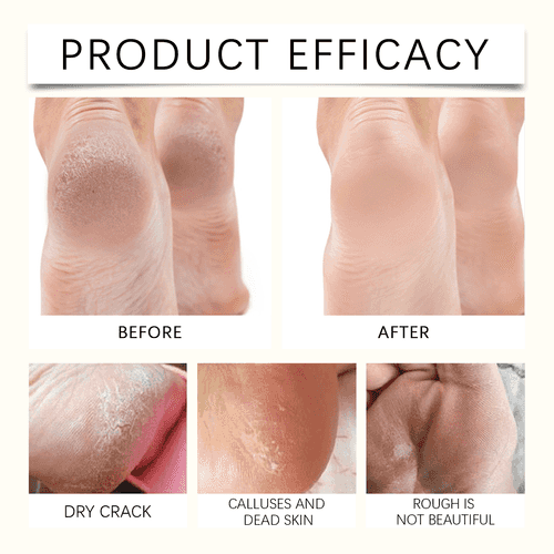 Hand and Foot Care Sticks for Dry Skin Relief