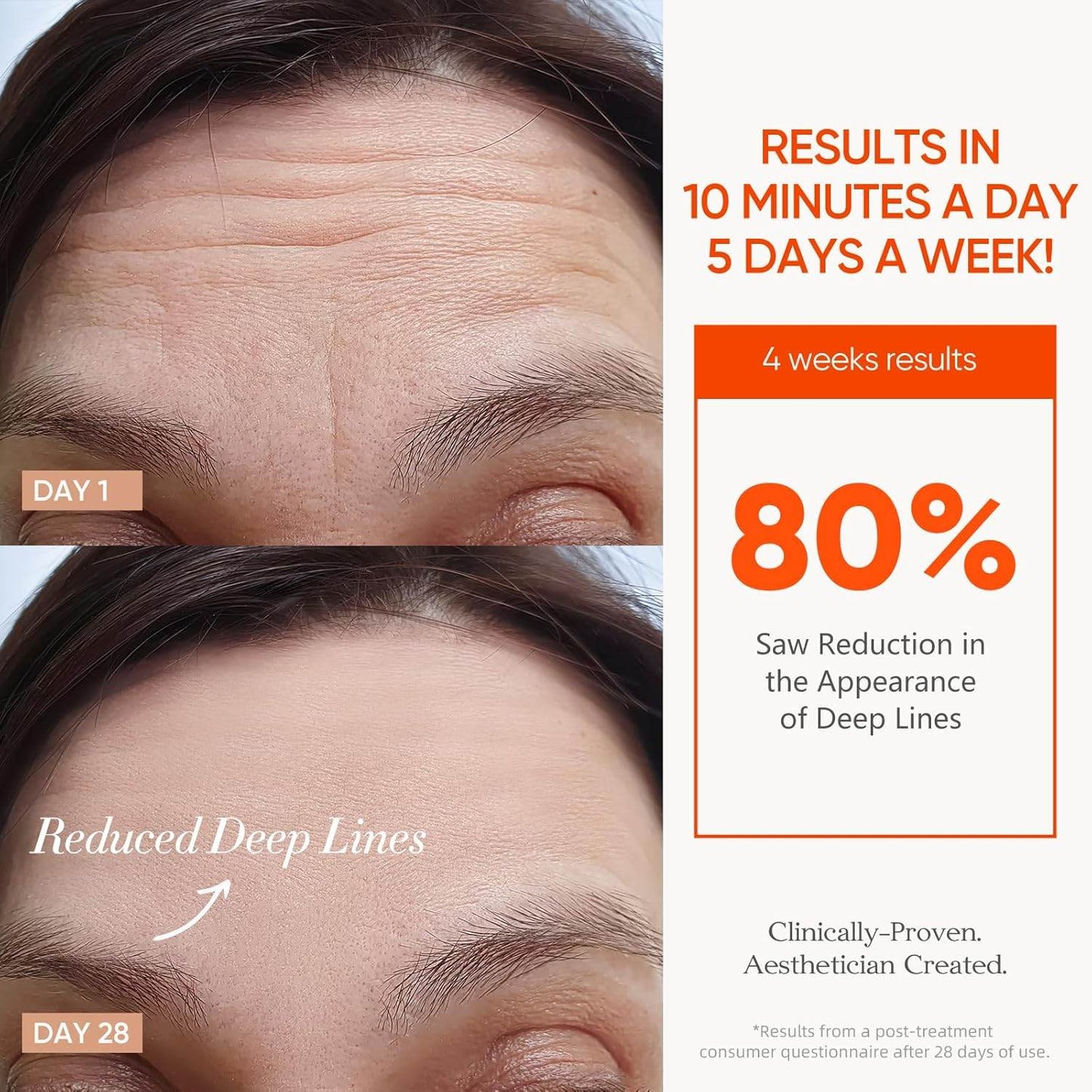 MLNshops LED Mask for Acne Treatment - Skin Care Solution