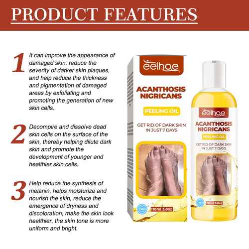 Product features graphic for aloeae Acanthosis Nigricans Peeling Oil, showing three numbered benefit points on a white background with a red header, alongside the product box and bottle.