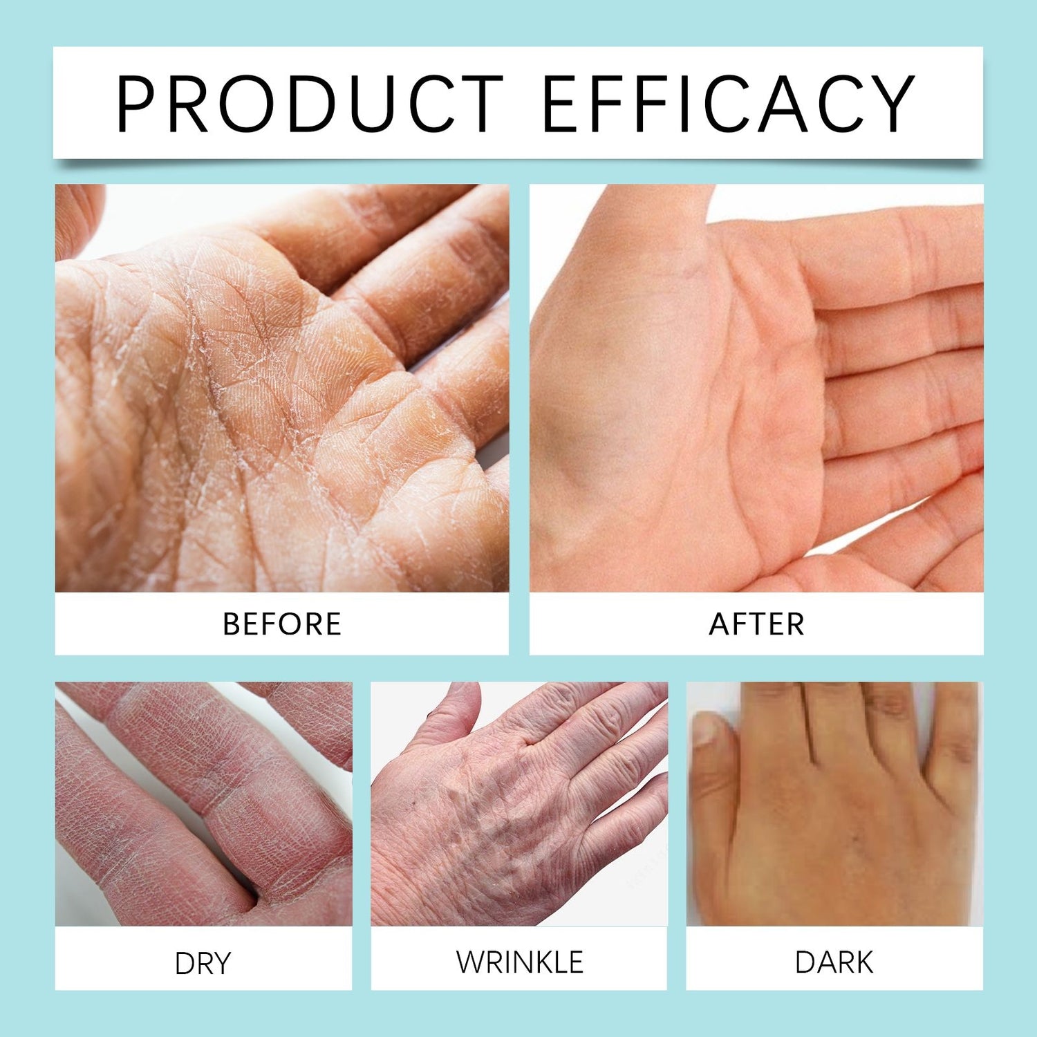 Before and after comparison of skin conditions on hands with text &