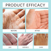 Before and after comparison of skin conditions on hands with text &