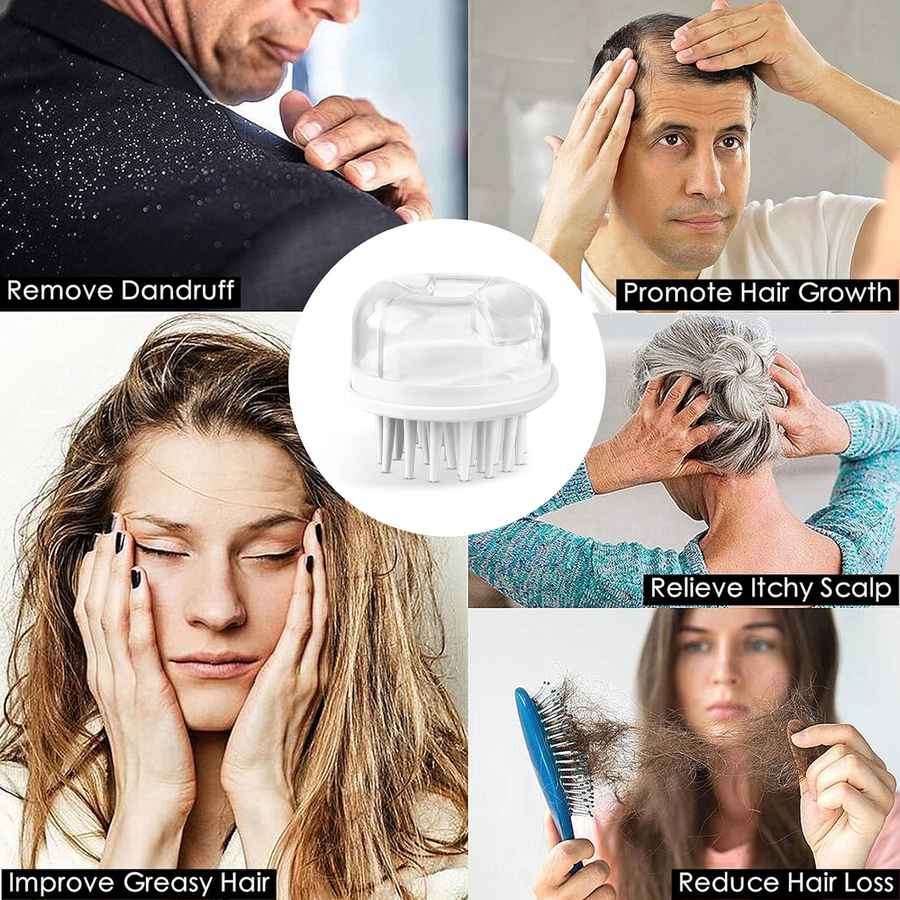 Collage of people dealing with scalp issues with a central focus on a hair care product.