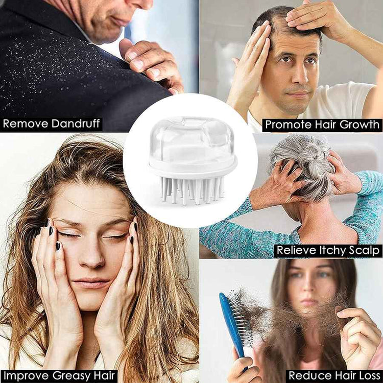 Collage of people dealing with scalp issues with a central focus on a hair care product.