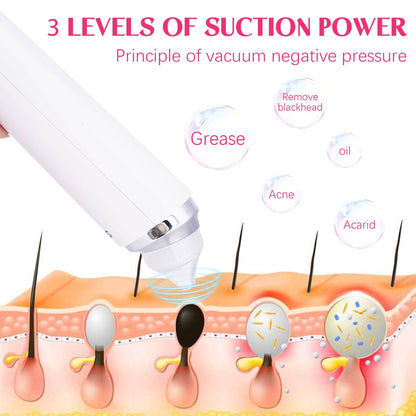 Vacuum Blackhead Remover with 6 Suction Heads, WIFI Visible Facial Pore Cleanser with HD Camera  USB Rechargeable Electric Blackhead Suction Tool