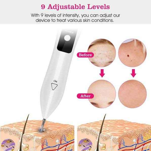 2 PCS Top-Rated Skin Tag Repair Kit - Portable, User-Friendly, USB Charging with Adjustable LCD & 12 Replaceable Needles