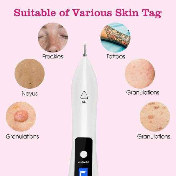 2 PCS Top-Rated Skin Tag Repair Kit - Portable, User-Friendly, USB Charging with Adjustable LCD & 12 Replaceable Needles