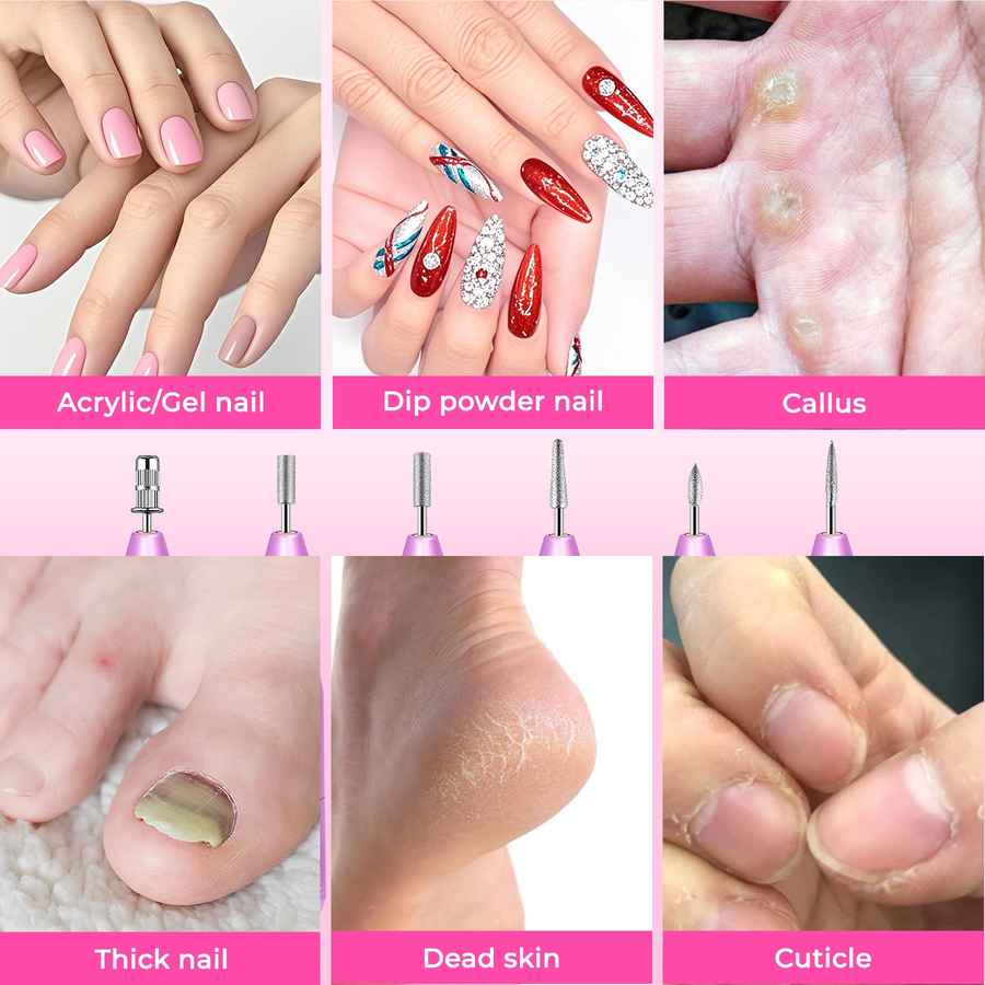 Collage of nail care issues including acrylic/gel nails, dip powder nails, callus, thick nail, dead skin, and cuticle.
