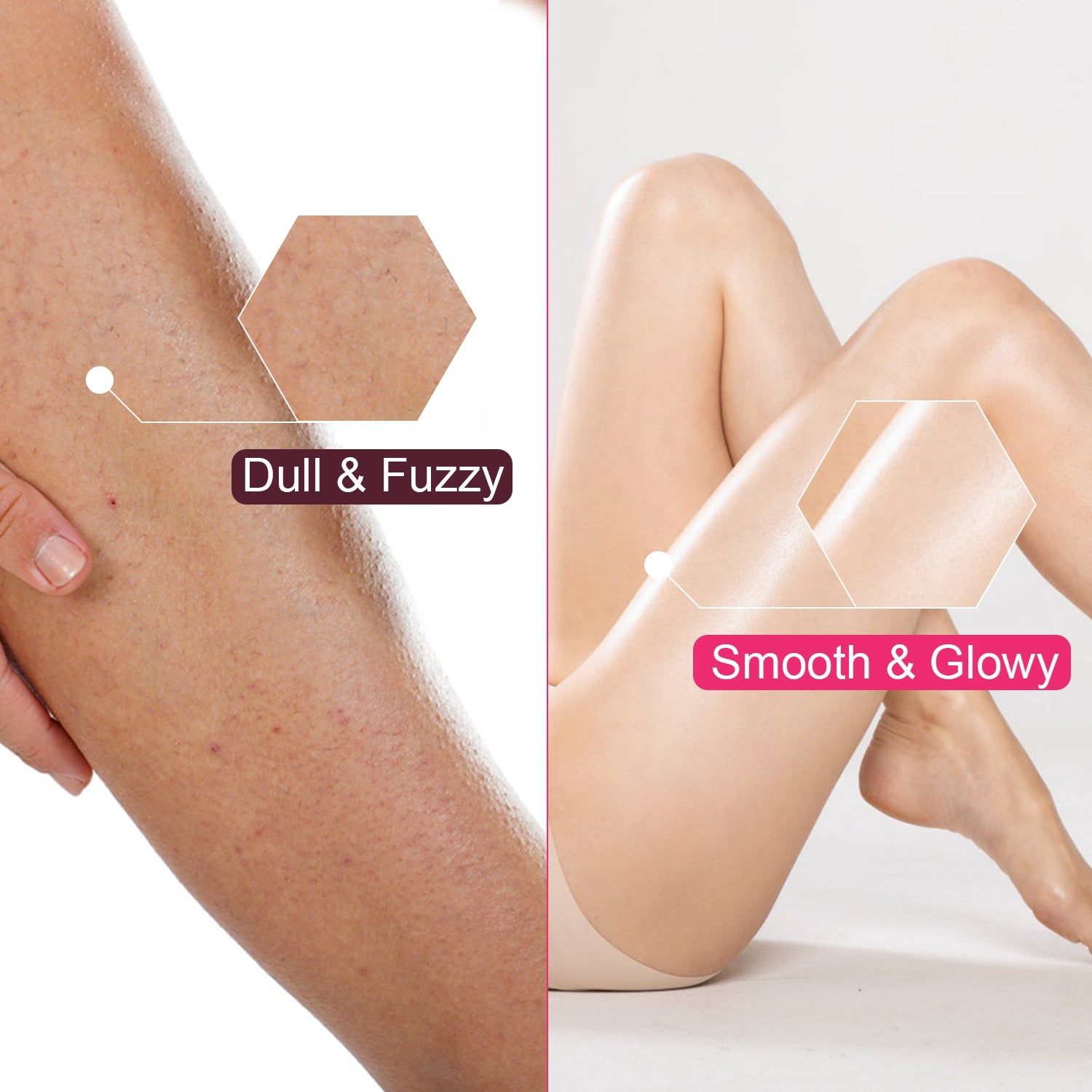 5 In 1 Electric Body Epilator Rechargeable Women&