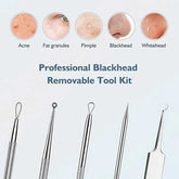 Blackhead remover lumps Popper tool kit with diagonal tweezers