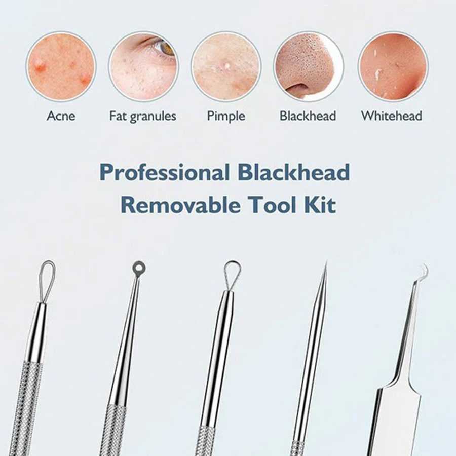 Blackhead remover lumps Popper tool kit with diagonal tweezers