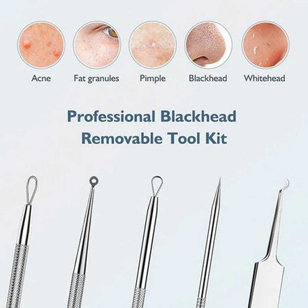 Blackhead remover lumps Popper tool kit with diagonal tweezers