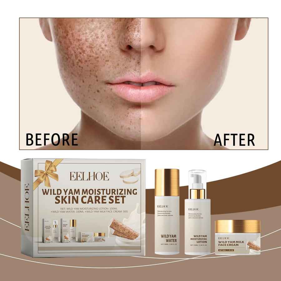 Before and after comparison of skin with Eelhoe Wild Yam Moisturizing Skin Care Set displayed.
