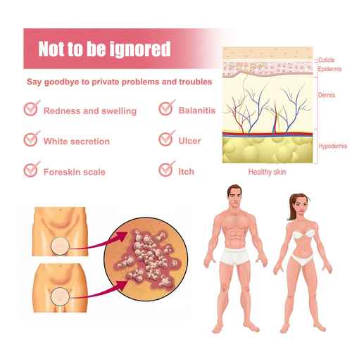 Diagram showing symptoms of skin conditions and a healthy skin cross-section.