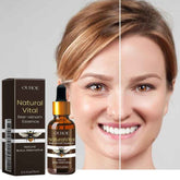 OUHOE Natural Vital Bee venom Essence bottle and packaging with a woman&