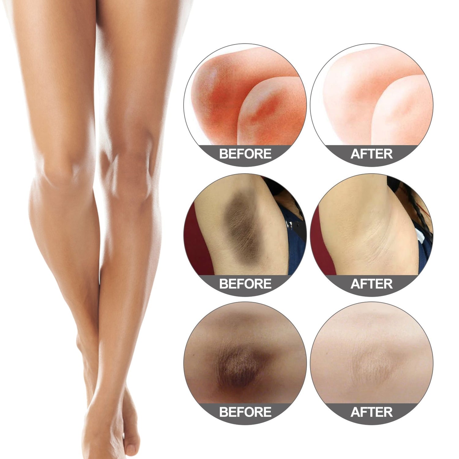 Before and after comparison of skin treatment on a leg
