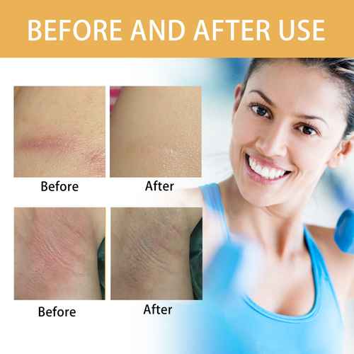 Before and after use comparison graphic showing skin irritation on skin close-ups labeled &