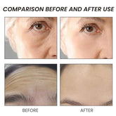 Before and after comparison of skin texture and lines on a person&