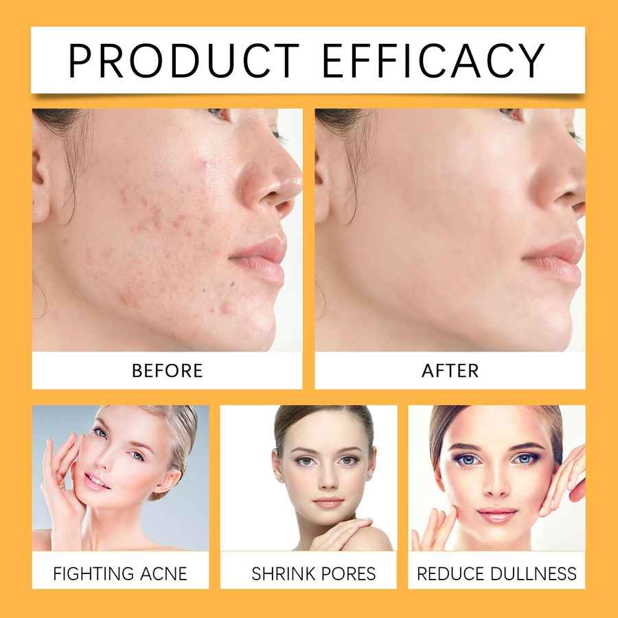 Before and after effects of a skincare product on a woman&