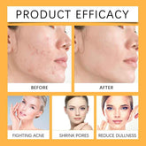 Before and after effects of a skincare product on a woman&