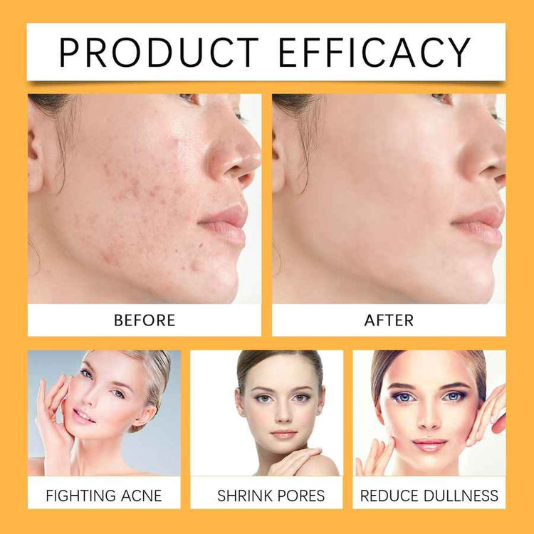 Before and after effects of a skincare product on a woman&