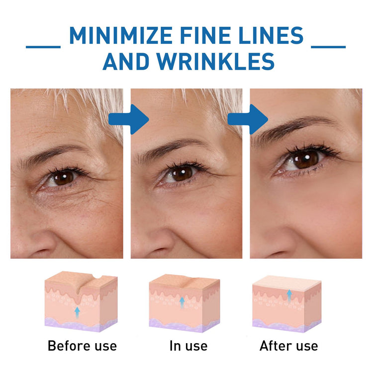 Before and after images of skin showing reduction in wrinkles, improved skin texture, and increased firmness after treatment