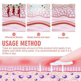 Illustration of a skincare product usage method with steps on skin affected by bacteria, sterilization, and nourishment.