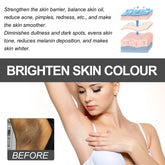 Advertisement for skin brightening product showing before and after effects on skin color.