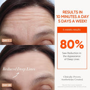 MLNshops LED Mask for Acne Treatment - Skin Care Solution