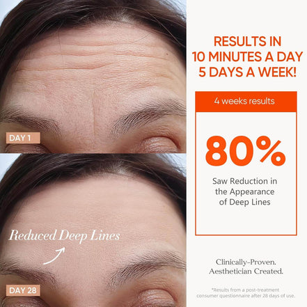 MLNshops LED Mask for Acne Treatment - Skin Care Solution