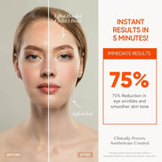 MLNshops LED Mask for Acne Treatment - Skin Care Solution