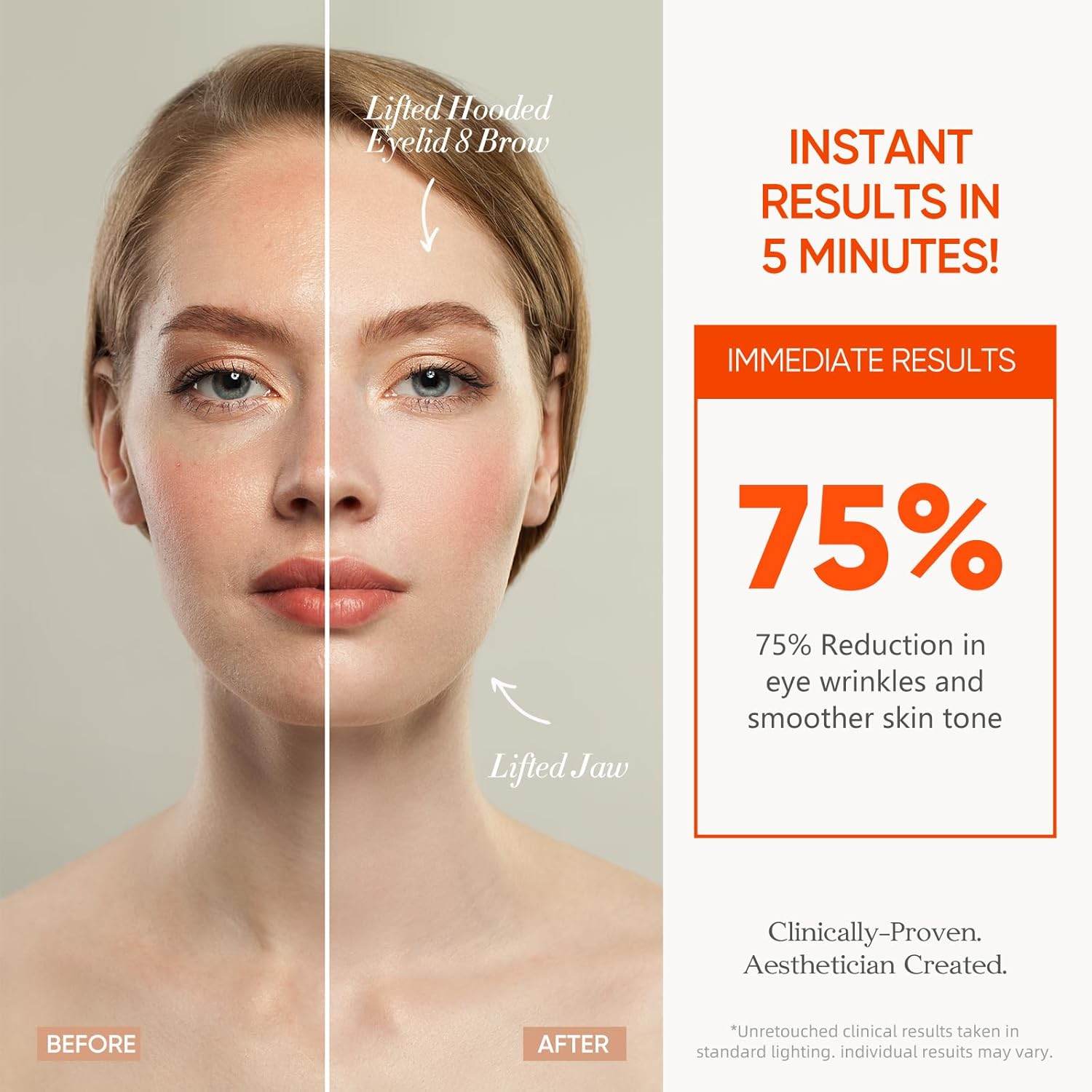 MLNshops LED Mask for Acne Treatment - Skin Care Solution