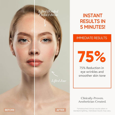 MLNshops LED Mask for Acne Treatment - Skin Care Solution