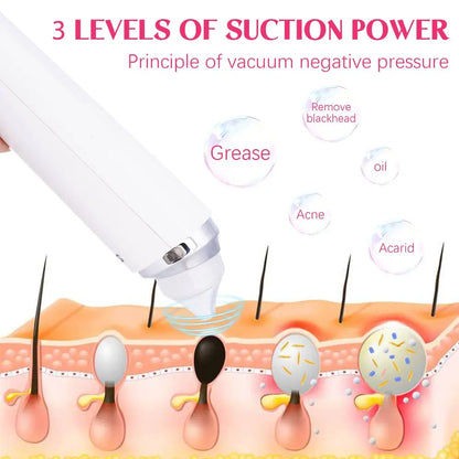 Vacuum Blackhead Remover with 6 Suction Heads, WIFI Visible Facial Pore Cleanser with HD Camera USB Rechargeable Electric Blackhead Suction Tool MLNshops]